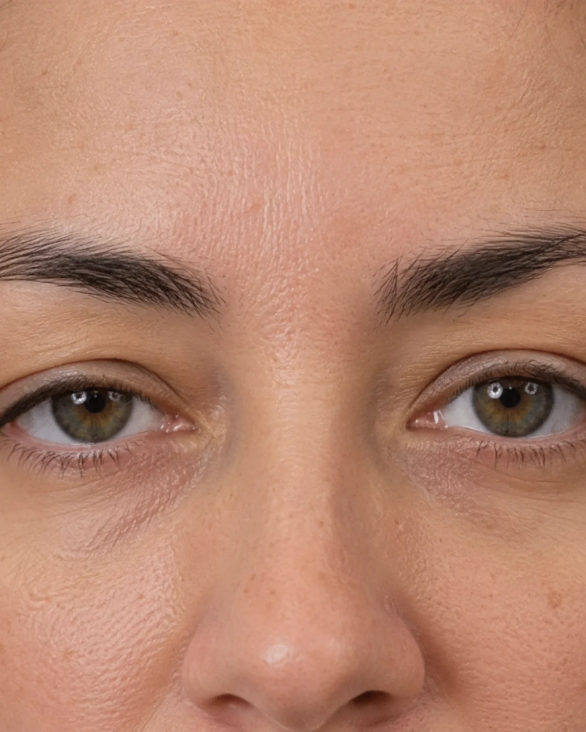 Close-up showing periocular skin firmness around the eyes
