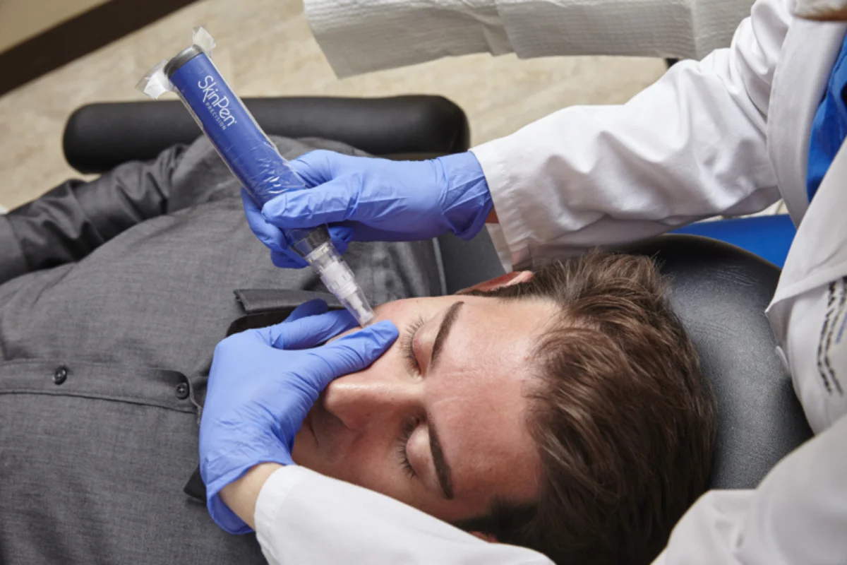 SkinPen microneedling at Victoria Park Clinic, London